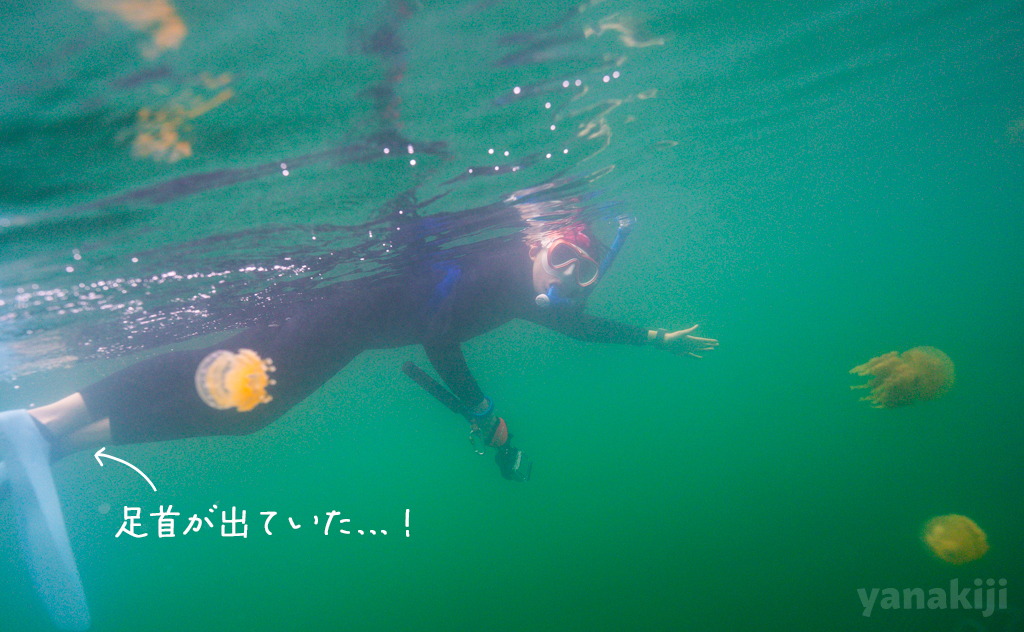 足首が出ていた